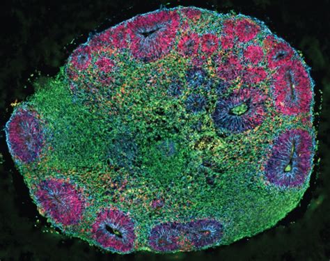 3d penis model|These 3D model brains with cells from several people are first of .